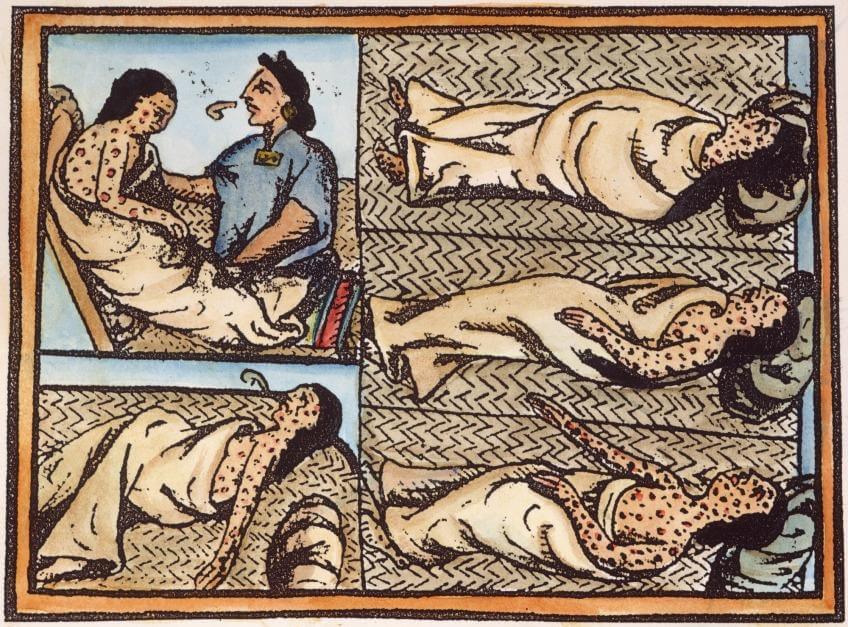 Epidemias en la América de la Conquista viruela Tenochtitlan